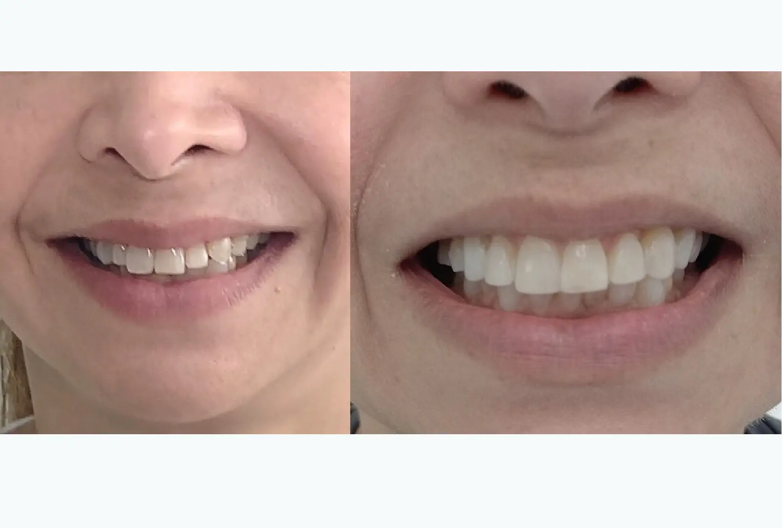 Estética y diseño funcional
